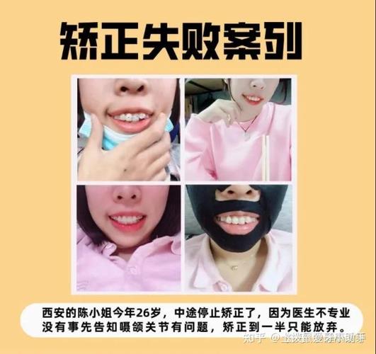 广州28岁矫正牙齿还来得及吗?我的经历和答案