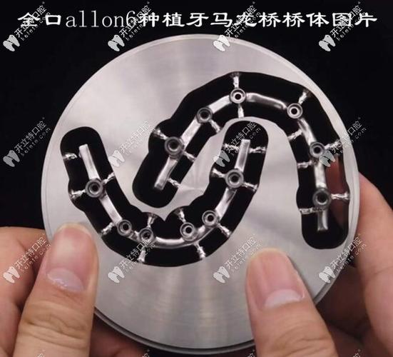 广州深圳半口All-on-4种植牙医院怎么选？地址与避坑指南