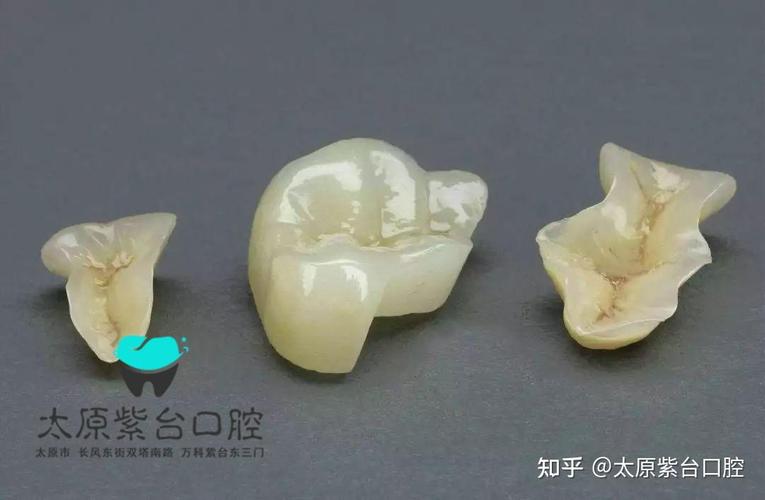 广州口腔检查反馈单看不懂？3步教你秒读