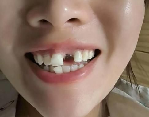 广州看牙能网上问医生吗？口腔在线解答到底靠不靠谱