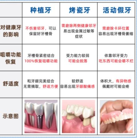 广州赤峰种牙别乱选 公立三甲医院才靠谱