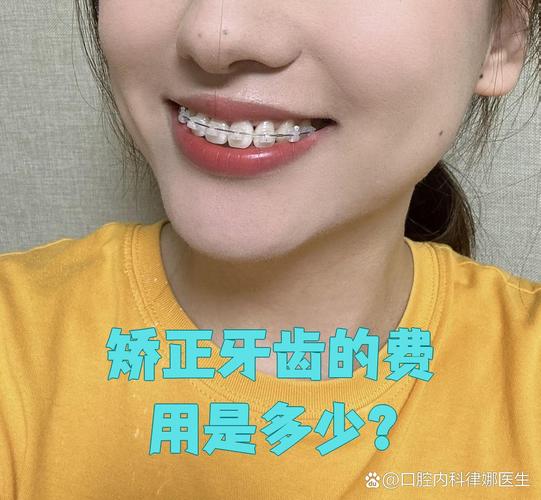 广州纠正牙型费用全解析：矫正牙齿一般要多少钱