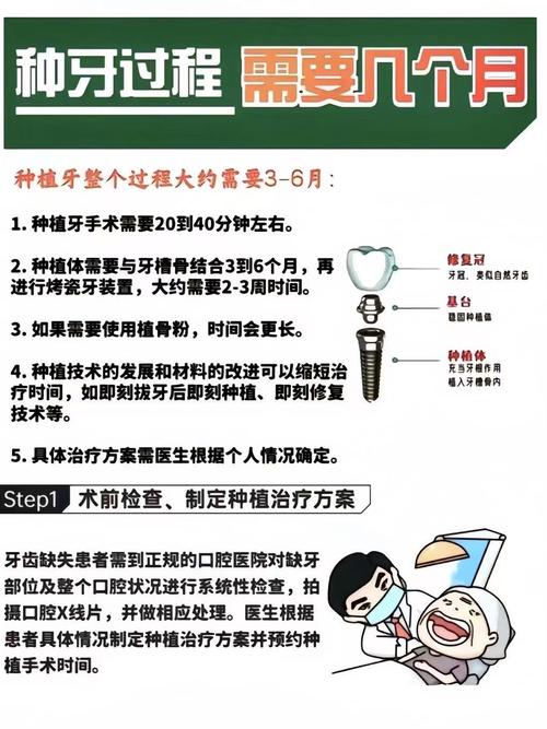广州半口种植牙能用多久？医生技术好能管20年