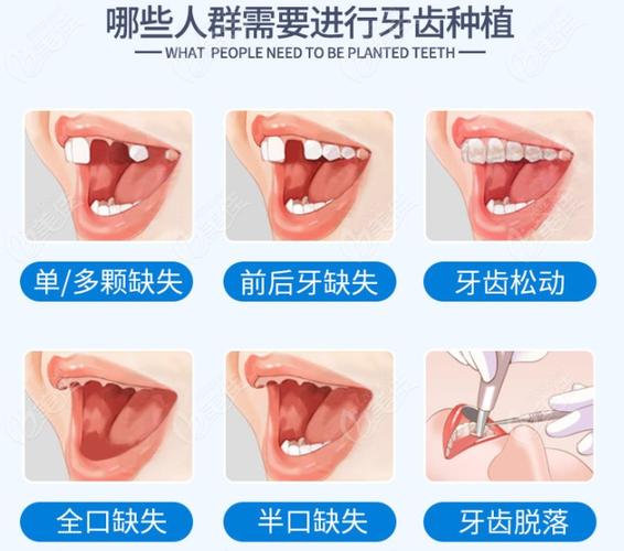 广州保定口腔医院收费多少钱?看牙项目全解析