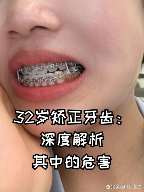 广州26岁做牙齿矫正来得及吗？牙周健康是关键