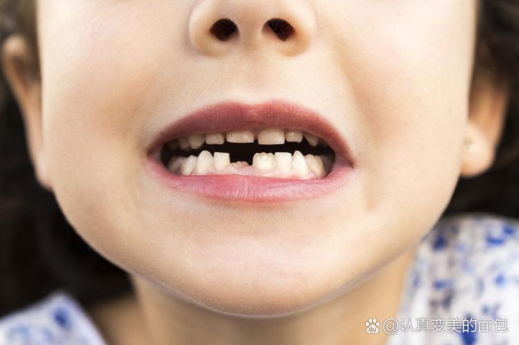 广州8岁孩子牙齿矫正哪种方法好