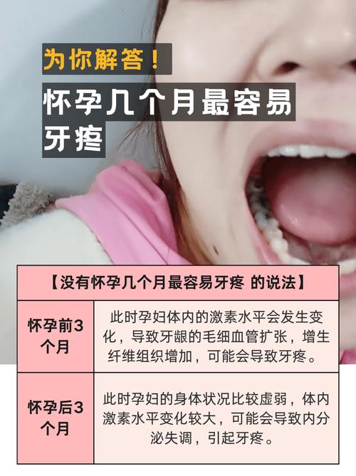 广州经期孕期感冒期，期间可以种牙吗？看身体状态定