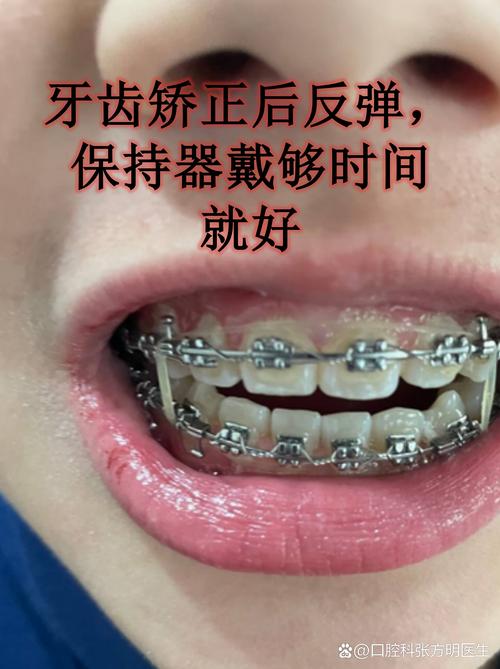 广州6d牙齿矫正器有用吗？牙医揭秘：美容陷阱，小心伤牙