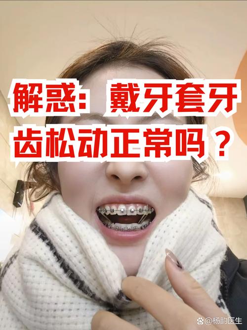 13岁牙齿矫正的后遗症有哪些_牙齿矫正后遗症有多可怕_牙齿矫正有后遗症没