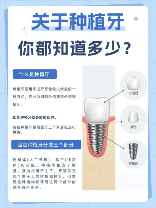 广州4颗牙一起种到底靠不靠谱 种植医生一次性讲清楚