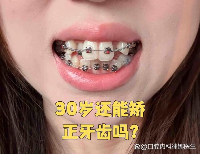 广州成年人也能做矫正 牙齿年龄限制真相大揭秘
