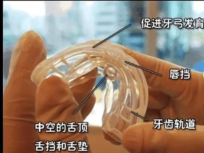 广州深圳南山儿童隐形MRC矫正费用到底多少钱？