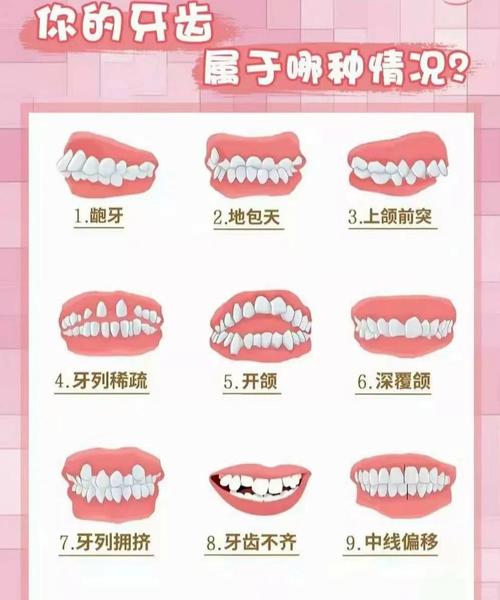 广州孩子几岁矫正牙齿最好 成人还能矫正吗