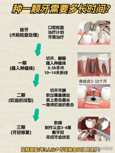 广州种牙前做CT是必须的吗 2026种牙CT检查费用全解析
