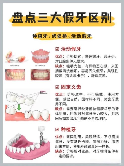 广州牙齿掉了是种牙还是镶牙 种牙过程和价格一文说清