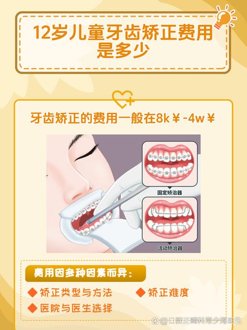 广州12岁矫正牙齿要多少钱？医生揭秘各阶段费用明细