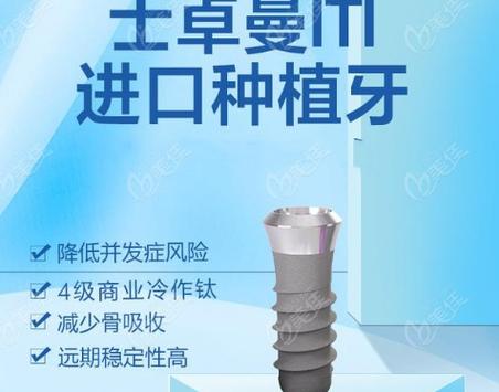 广州瑞士ITI种植牙好吗 医生实话实说优缺点和价格