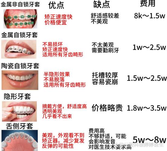 广州深圳龙华牙齿不齐钢丝矫正费用多少钱?