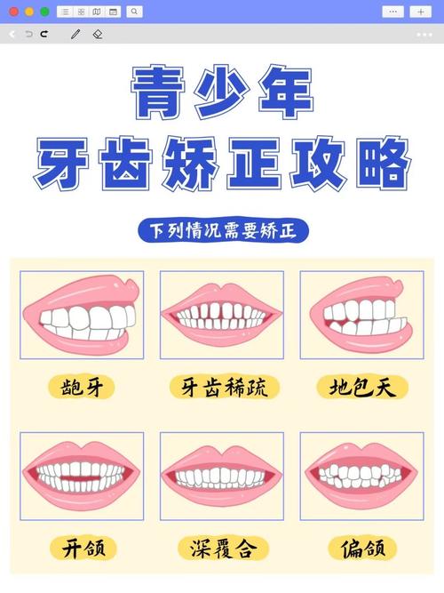 广州15岁牙齿不齐别慌!抓住矫正黄金期,这些方法快收藏