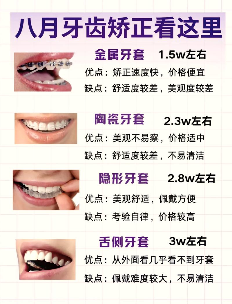 广州门牙突出矫正费用全解析 看完这篇不再被坑