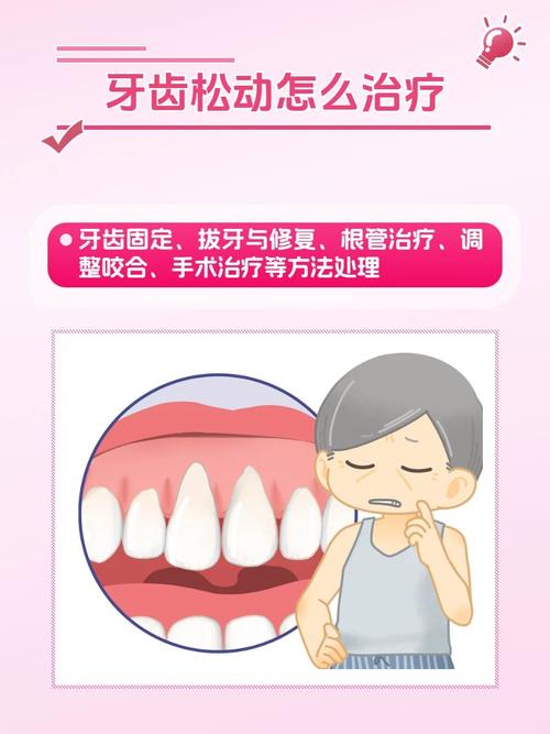 广州牙齿松动能即拔即种吗 医生说出3个关键条件
