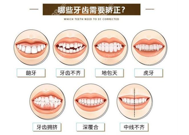 广州38岁矫正牙齿晚不晚 别让年龄成为你犹豫的借口