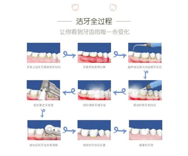 广州深圳宝安隐适美正品认证医院怎么选？