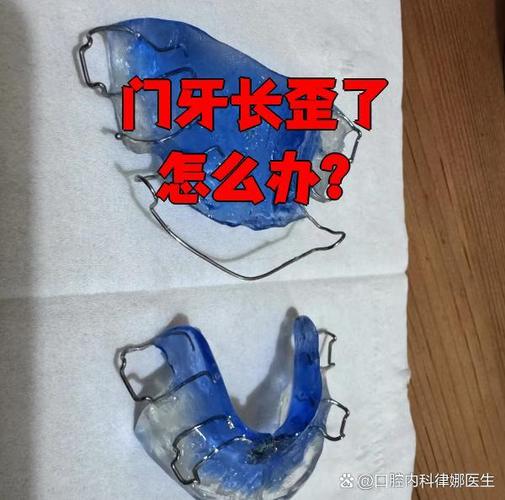 广州牙齿长歪了怎么矫正？多少钱能搞定？