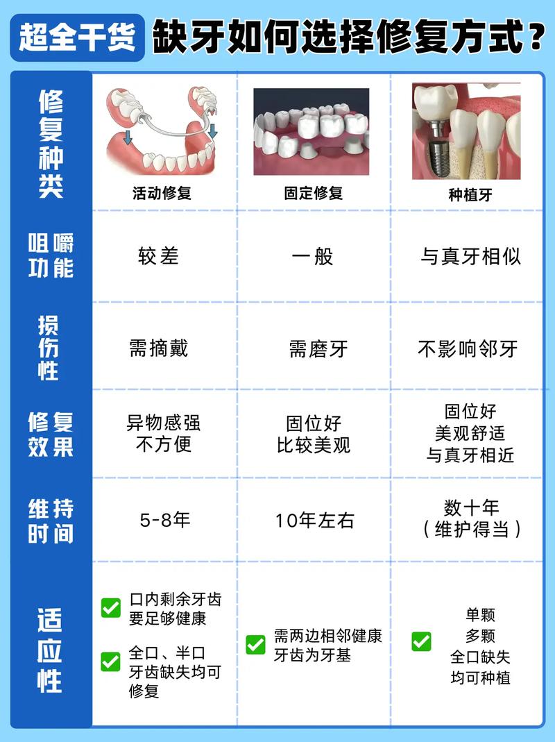 广州补牙种牙镶牙怎么选?牙医一次说清楚