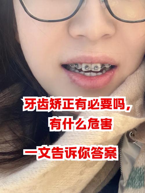 广州35岁隐形矫正晚不晚 成人正畸的真相与关键