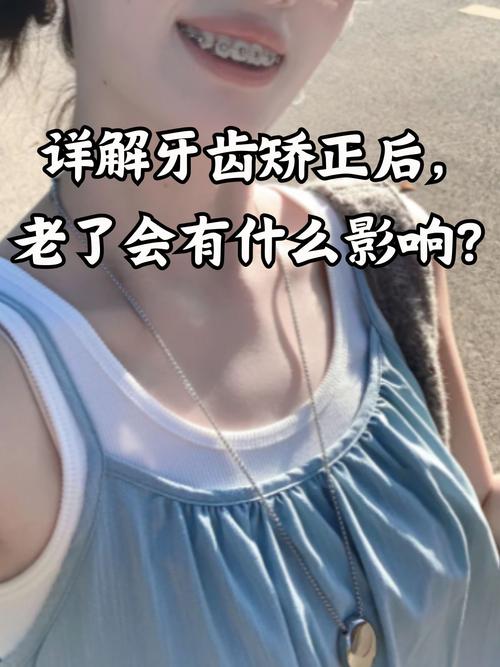 广州40岁还能矫正牙齿吗？看完这篇文章让你了解40岁牙齿矫正的真相