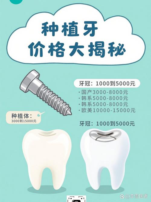 广州奥齿泰种牙贵不贵？一颗的价格究竟是多少？看完这篇就知道！