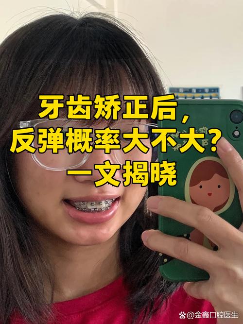 广州19岁做牙齿矫正晚不晚 过来人告诉你真实经历