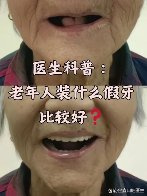 牙齿种植老人可以做吗_65岁老人牙齿可以种植_老人家种植牙齿能正常吃饭吗