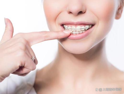 牙齿矫正的钱一次付吗_牙齿矫正可以退钱吗_30岁还可以矫正牙齿要多少钱