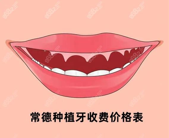 广州常德半口种植牙费用2026大概多少钱？真实价格参考